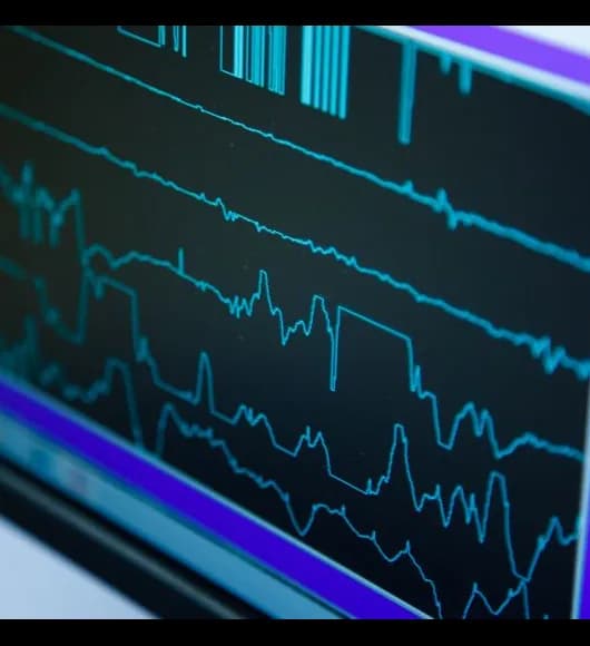 Tecnologia em monitoramento cardiovascular: essencial na luta contra doenças cardíacas. O alto número de casos e mortes por problemas cardiovasculares impulsiona inovações, que precisam ser incorporadas com agilidade e critério técnico